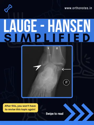 Lauge Hansen Classification Simplified preview