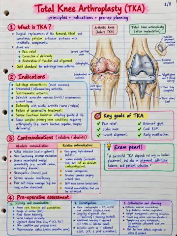 Total Knee Arthroplasty (TKA) preview